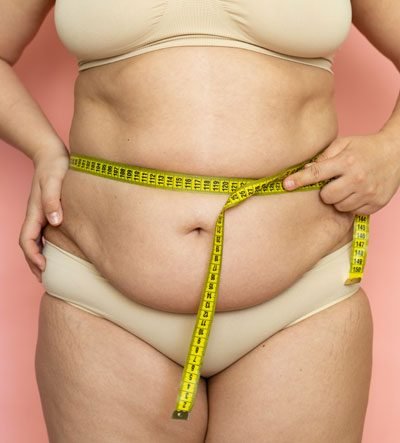 cirugia-bariatrica-colombian-medical-care